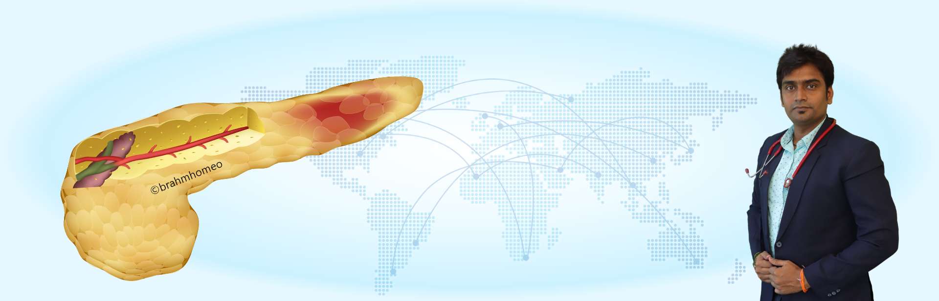 Acute Pancreatitis